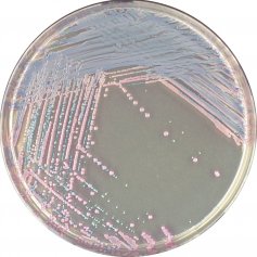 法国科玛嘉金黄色葡萄球菌显色培养基